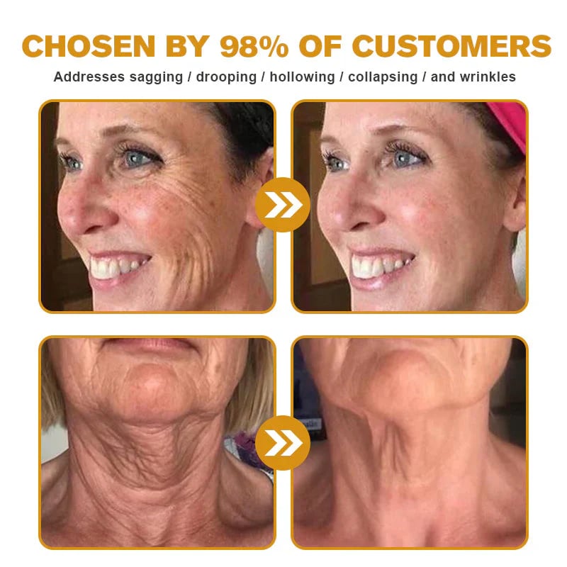 Bee Venom Wrinkle Removal Cream, Anti-Aging, Restore and Enhance Skin Elasticity, Natural and Non-Irritating, Suitable for Sensitive, Dry, Oily Skin
