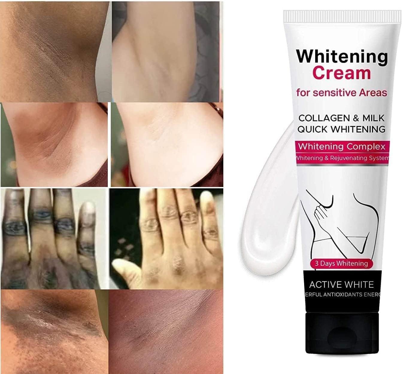 Whitening Cream For Dark Skin Underarm