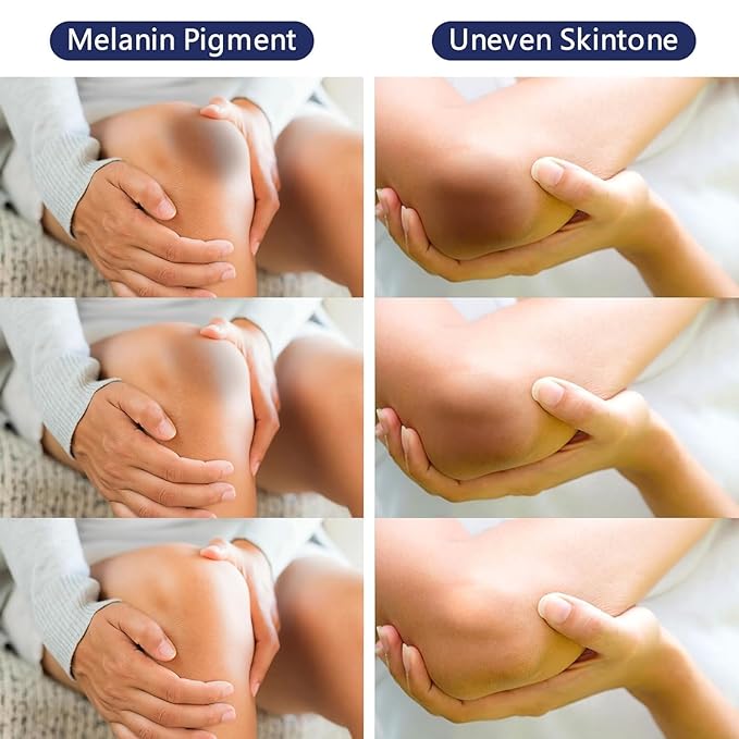 Whitening Cream For Dark Skin Underarm