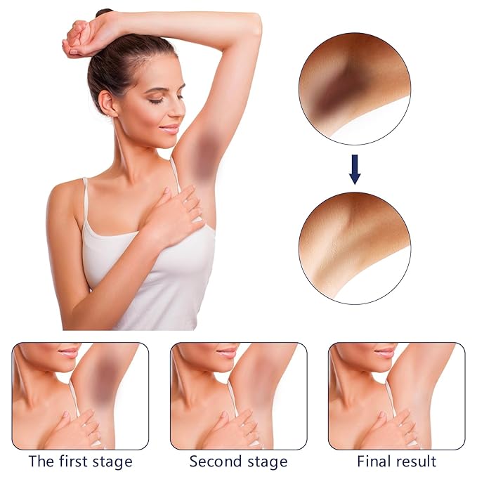 Whitening Cream For Dark Skin Underarm