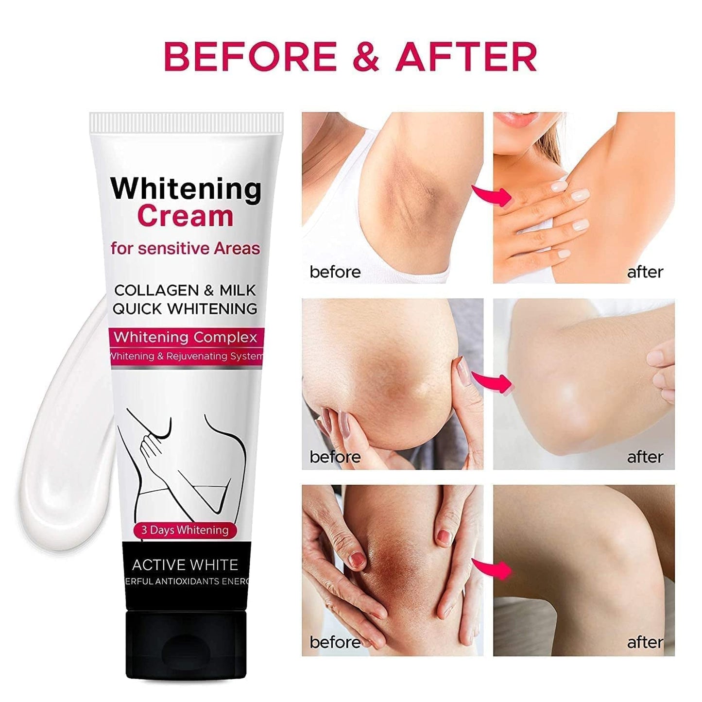 Whitening Cream For Dark Skin Underarm