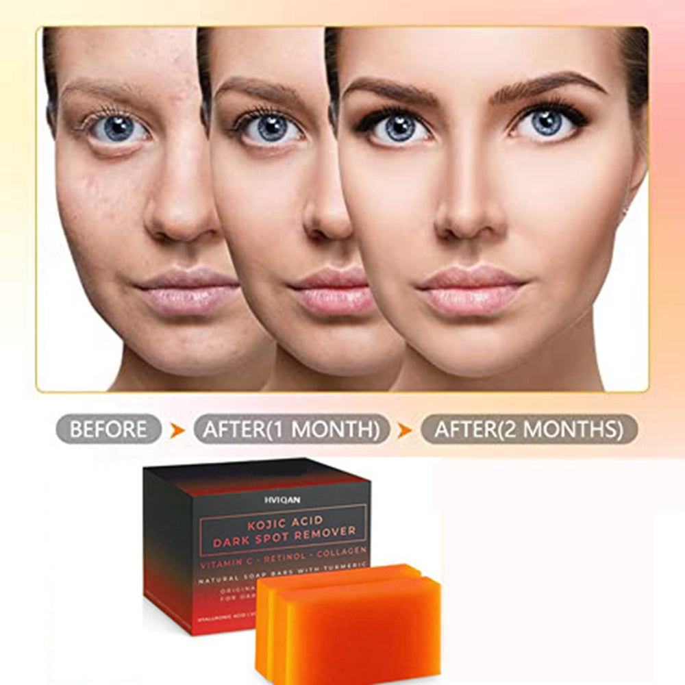 Kojic Acid Soap Whitening Soap