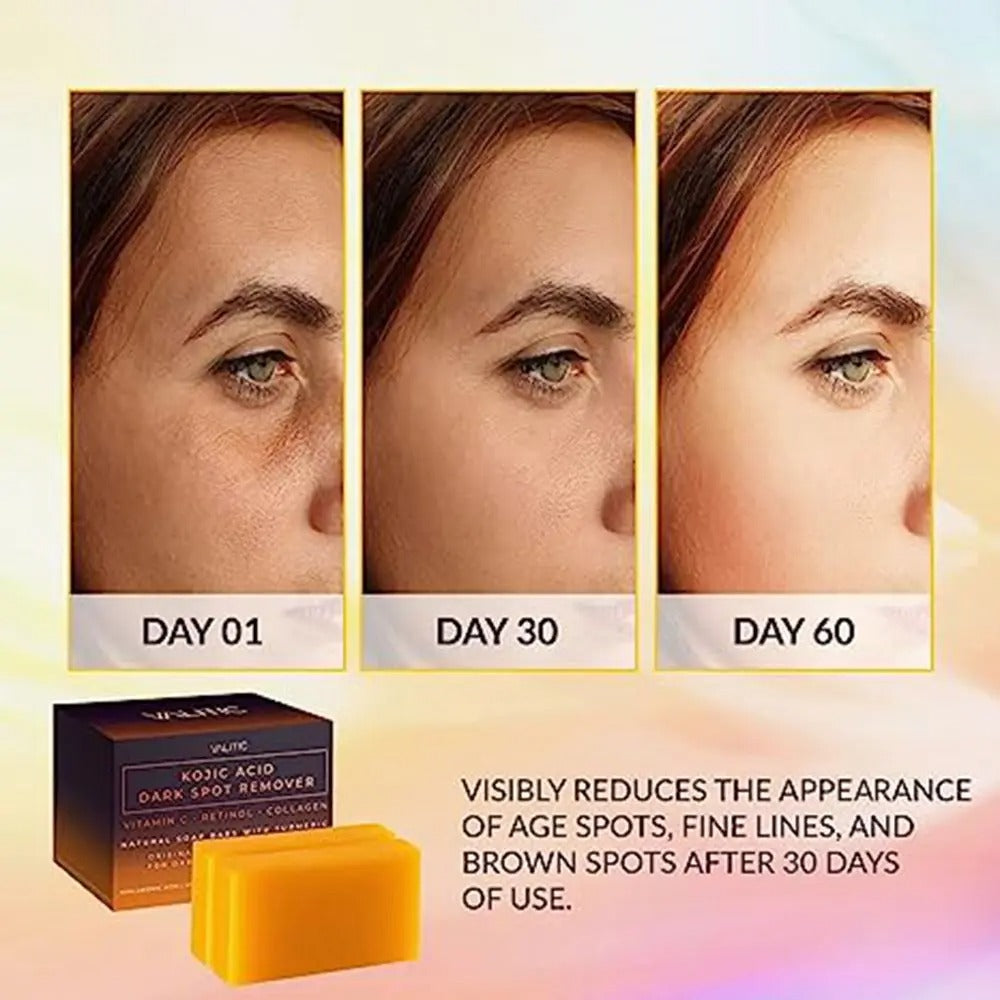 Kojic Acid Soap Whitening Soap