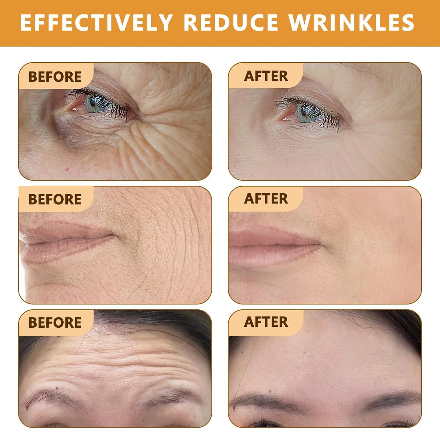 Bee Venom Wrinkle Removal Cream, Anti-Aging, Restore and Enhance Skin Elasticity, Natural and Non-Irritating, Suitable for Sensitive, Dry, Oily Skin