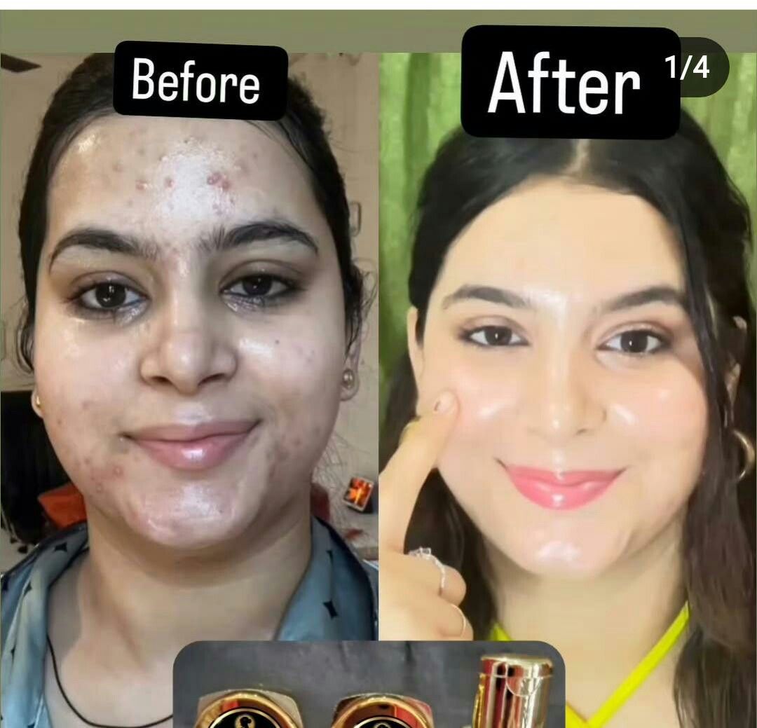 7 Days Whitening Miracle Cream – For Face, Hands, and Body!✨