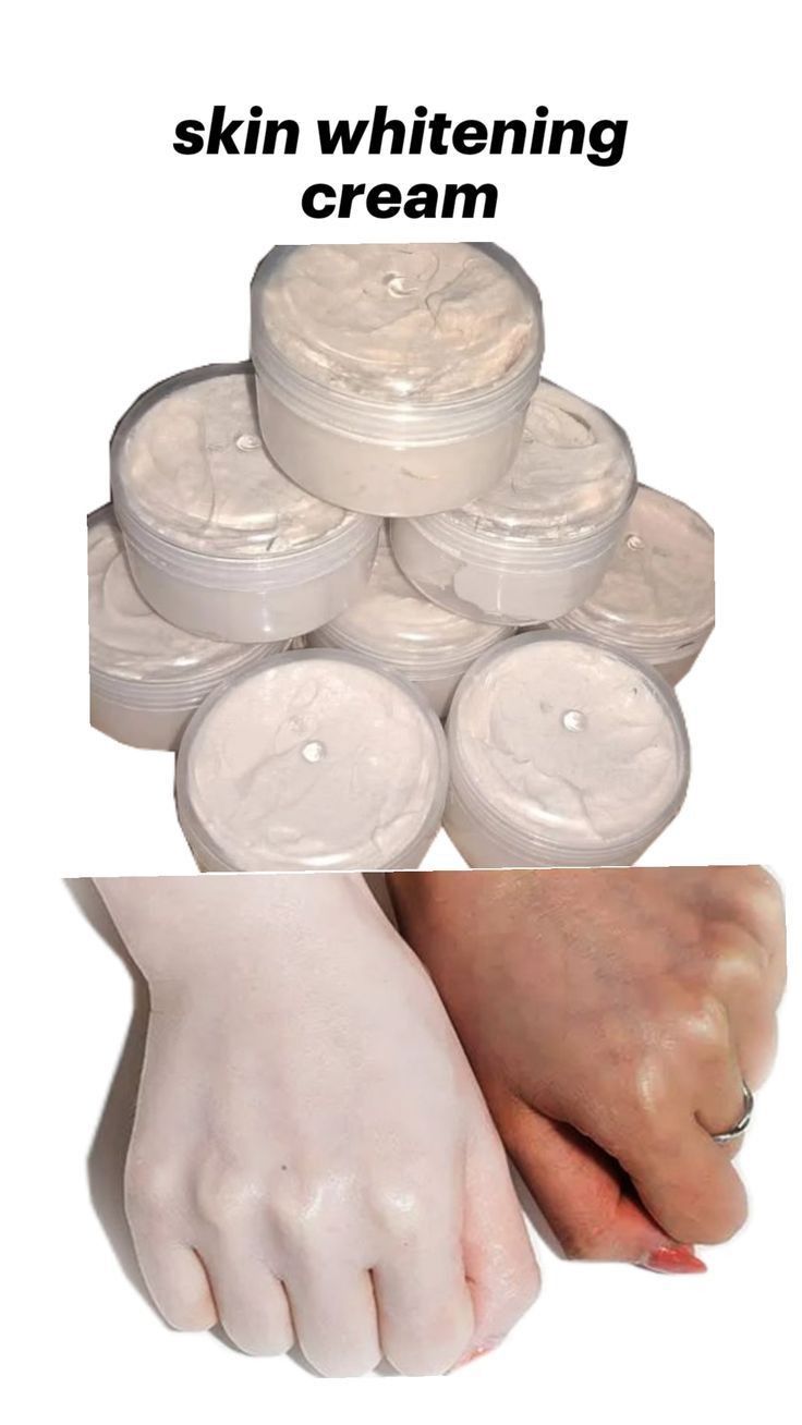 7 Days Whitening Miracle Cream – For Face, Hands, and Body!✨