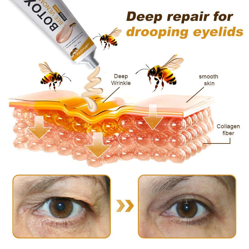 Bee Venom Wrinkle Removal Cream, Anti-Aging, Restore and Enhance Skin Elasticity, Natural and Non-Irritating, Suitable for Sensitive, Dry, Oily Skin